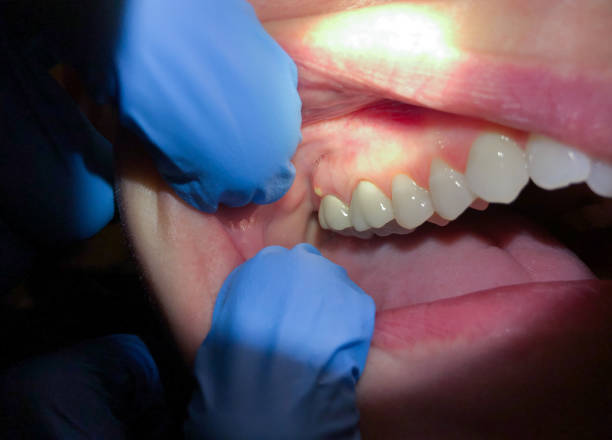 Best Emergency Cosmetic Dentistry in Wolcottville, IN